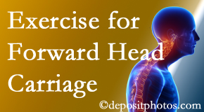 La Grande chiropractic treatment of forward head carriage is two-fold: manipulation and exercise.