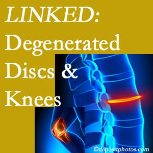 Degenerated discs and degenerated knees are not such strange bedfellows. They are seen to be related. La Grande patients with a loss of disc height due to disc degeneration often also have knee pain related to degeneration.  